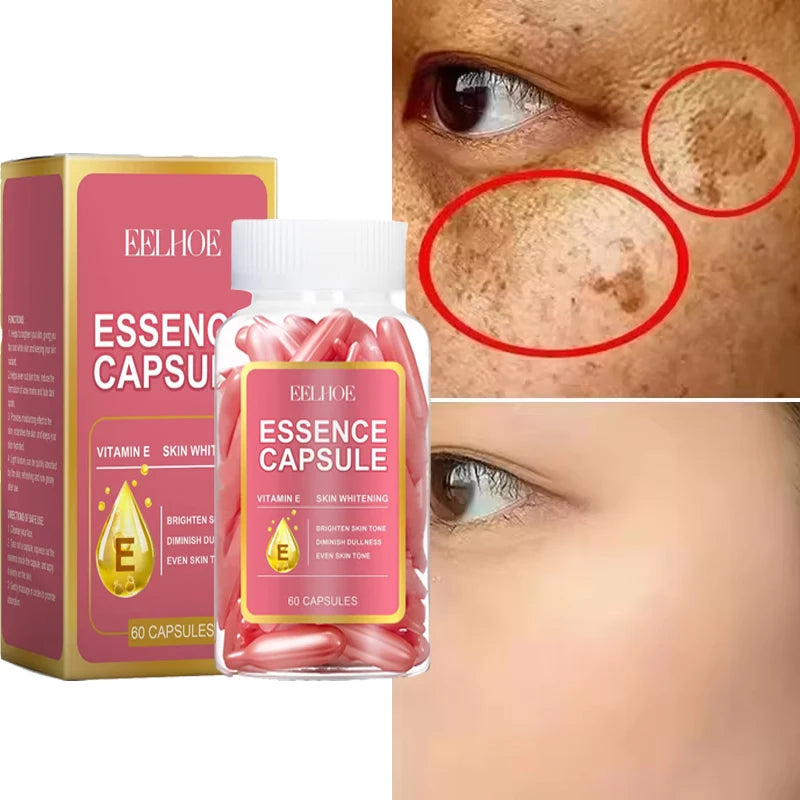 Vitamin E Dark Spots Remover Capsule Face Freckle Melanin Correct Anti Pigmentation Brighten Beauty Korean Day Night Skin Care