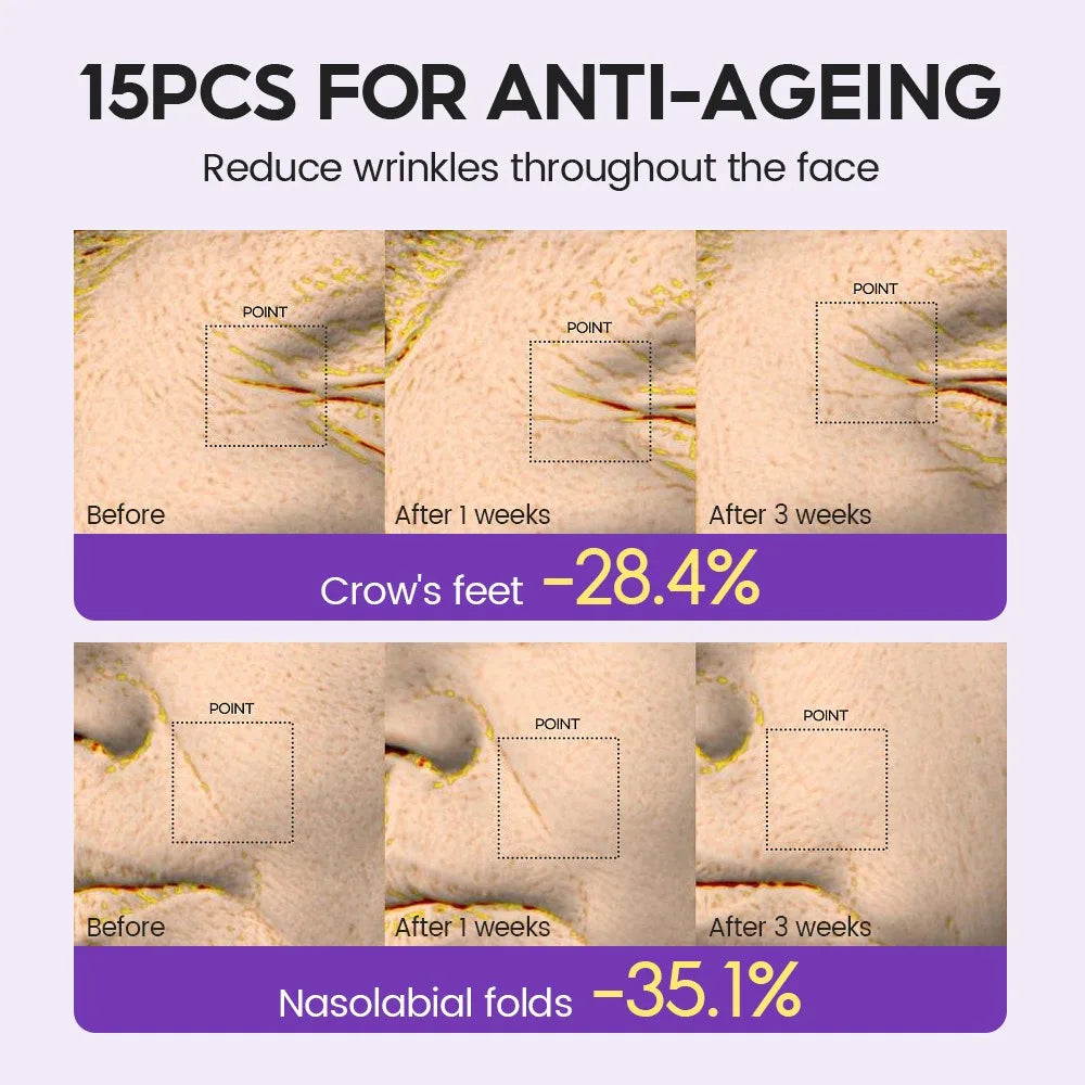 Retinol + Pro-xylane Ampoule serum Repairs Strengthens The Skin And Diminishes Fine Lines Face Beauty Skin Care 15pcs