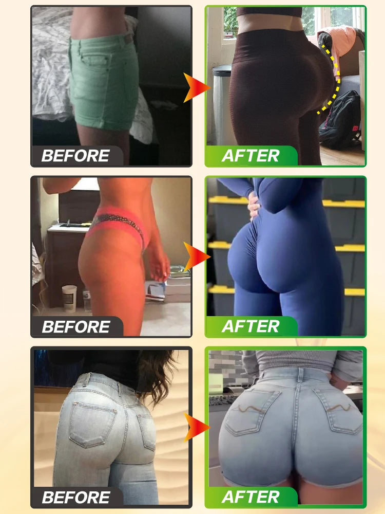Buttocks oil Enlarge buttocks Make them fuller Rounder More upright Shape