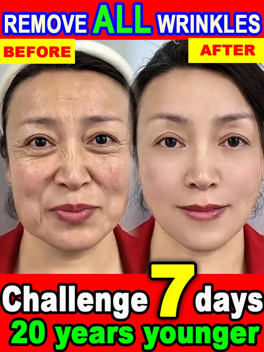 Wrinkles disappear,20 years younger